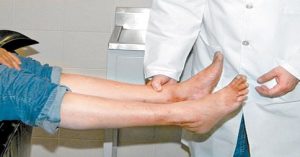 Usar hamamelis para la circulación de las piernas